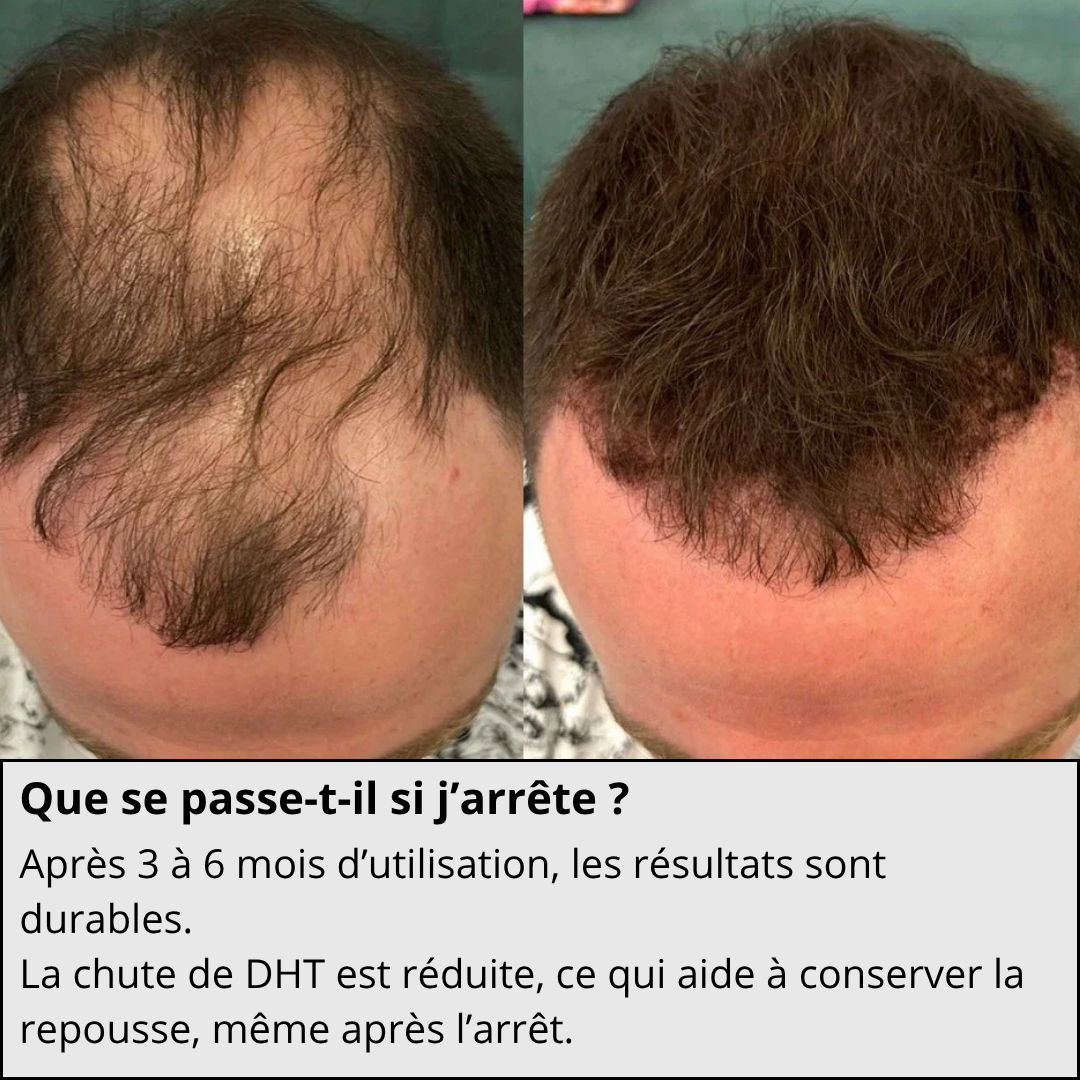 Technologie Capillaire  Micro-infuse®